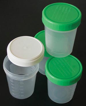 Adi Specimen Cup Case 2-122 By Adi Medical